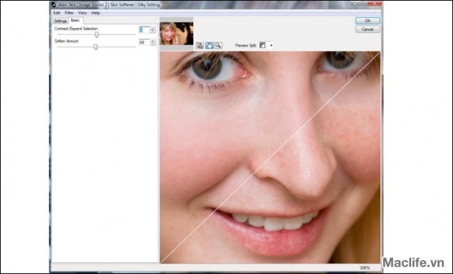 Alien Skin Image Doctor MacOs – Công cụ làm đẹp ảnh 1 alien skin image doctor